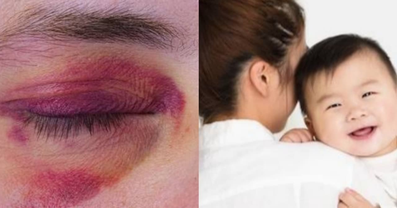 Nagalit ang Kaniyang Asawa at Napagbuhatan Siya ng Kamay; Iyon ay Dahil Lamang sa Limang Daang Piso